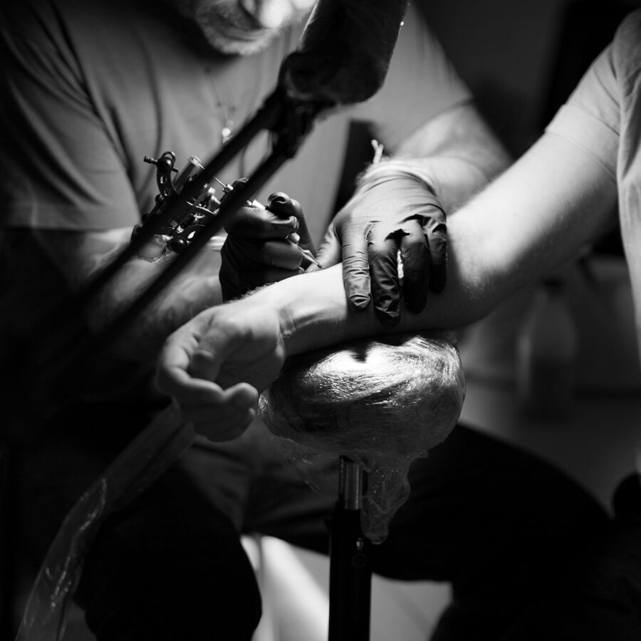 Remover tatuaje
